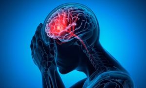 نجات از سکته مغزی با مصرف این ماده غذایی