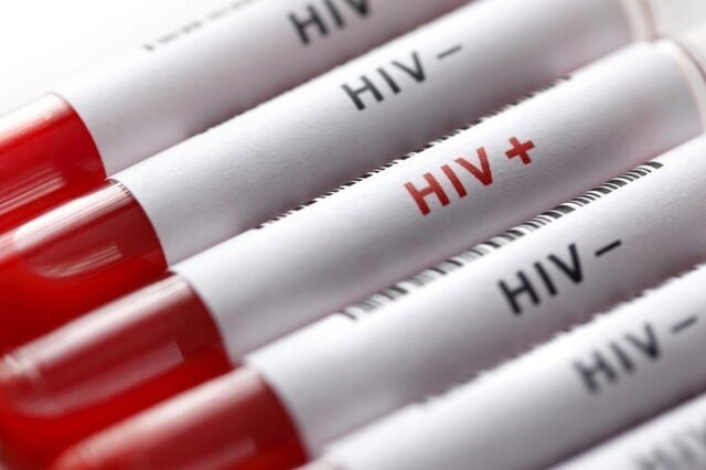 واقعیت انتقال HIV از استخر و سرویس بهداشتی