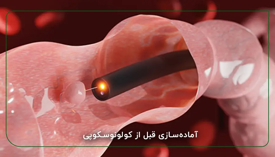 آمادهسازی قبل از کولونوسکوپی